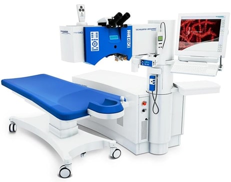 LASIK Eye Surgery Procedure